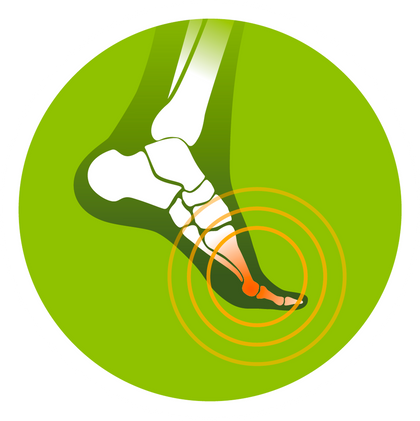 Joint pain